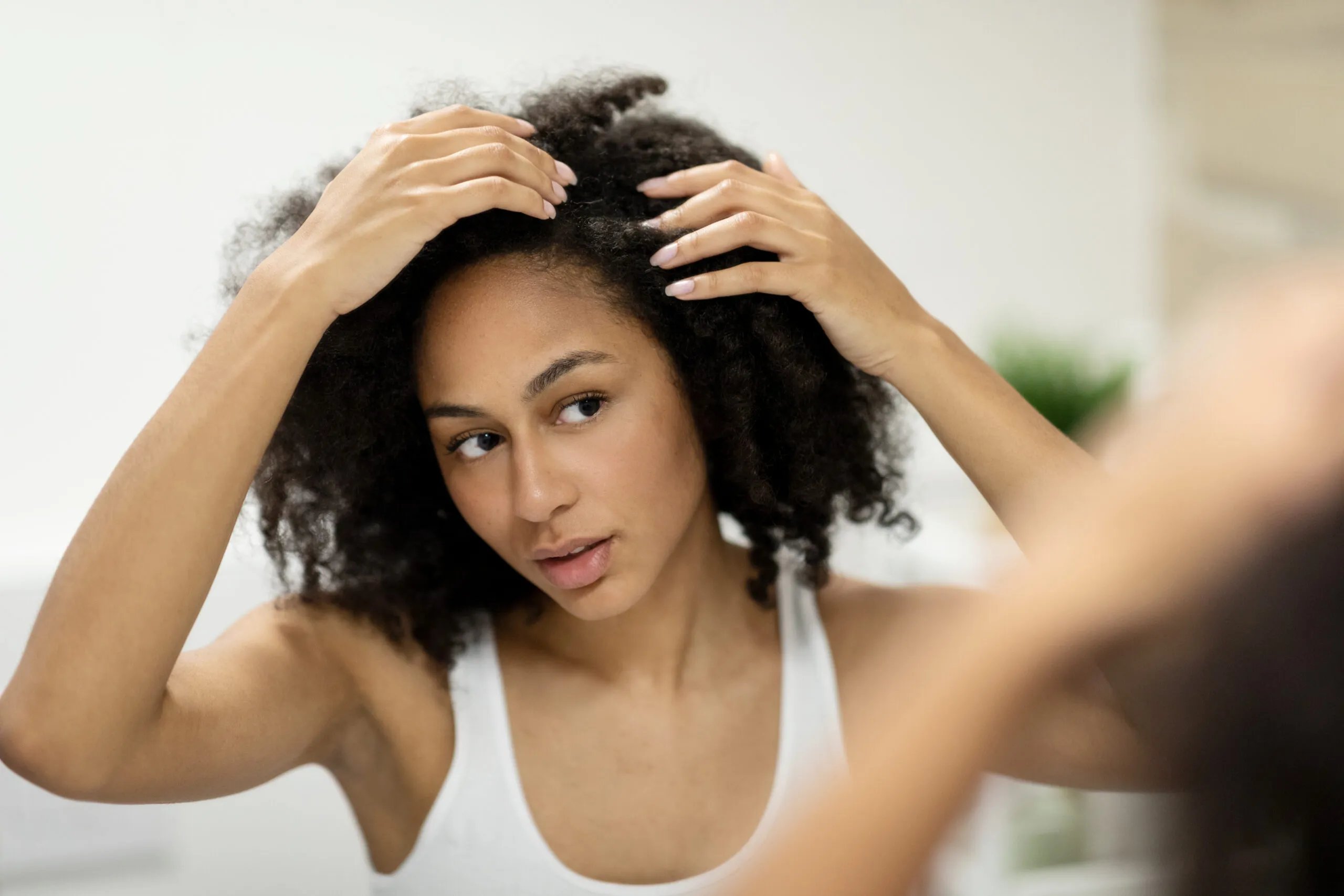 How To Treat Scalp Eczema With Natural Hair