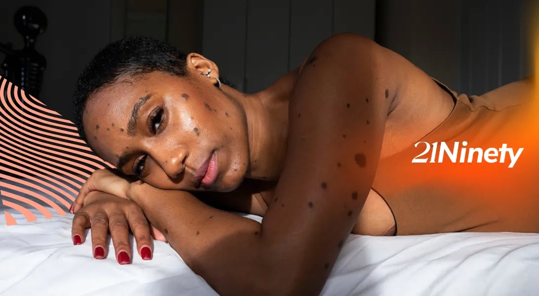 What Does Skin Cancer Look Like on Black Skin? Here's What to Know