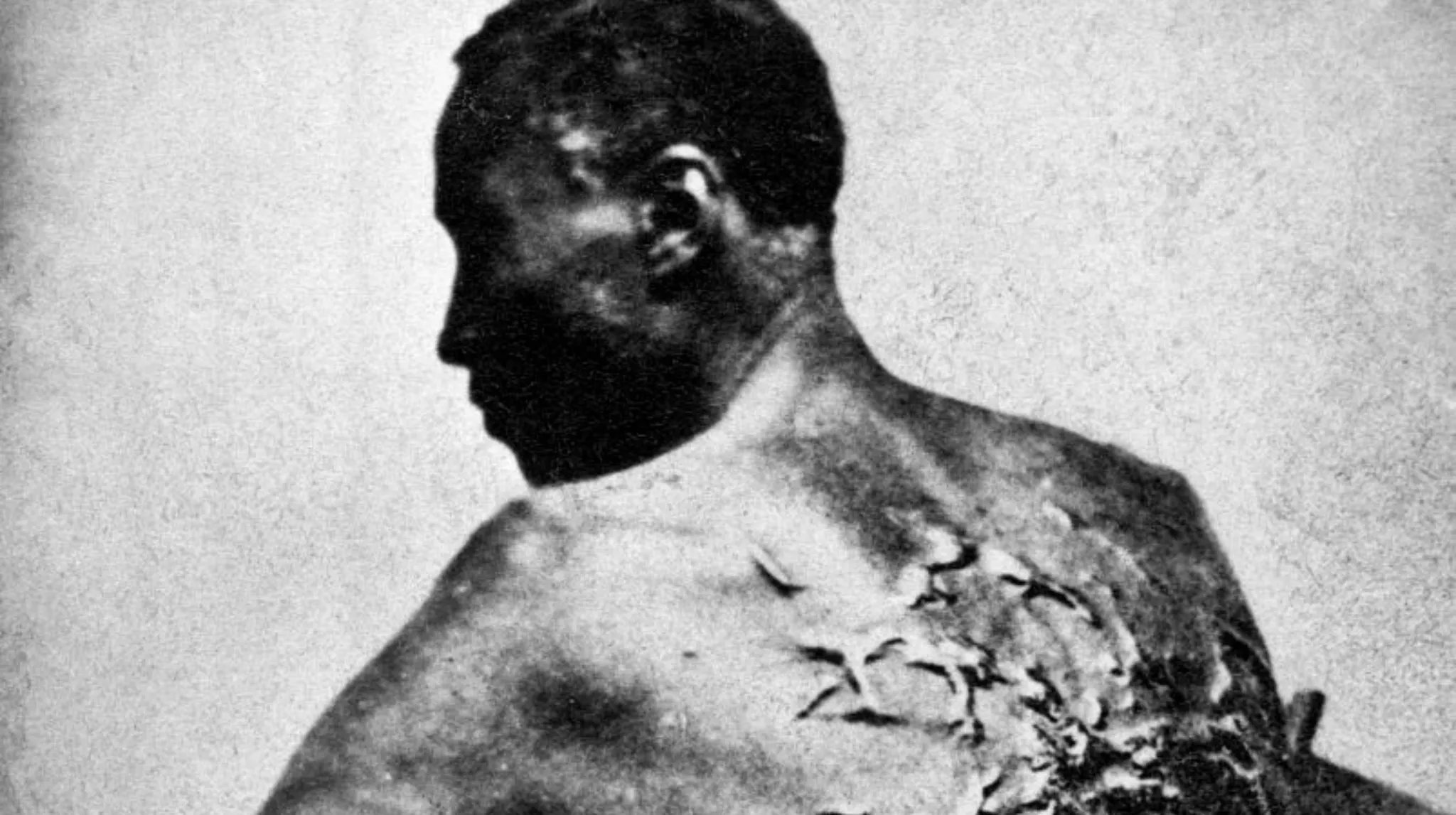 Trump Admin Orders Removal Of 'The Scourged Back' Photo And Other References To Slavery And Racism