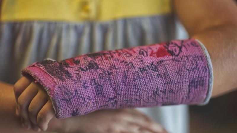 Adorable Video Shows Toddler's Reaction To Getting His Cast Removed