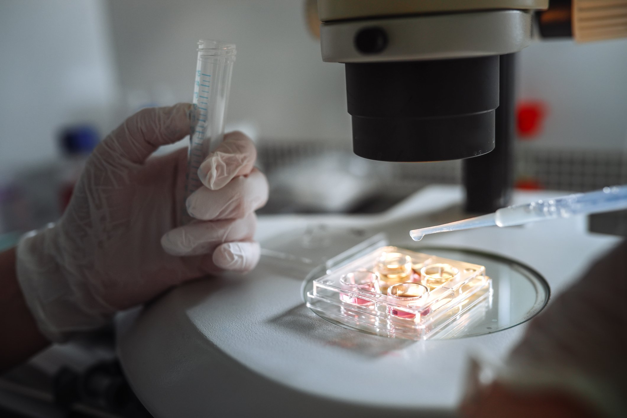 White Couple Who Birthed A Dark-Skin Baby Sues Fertility Clinic After Alleged Embryo Mixup