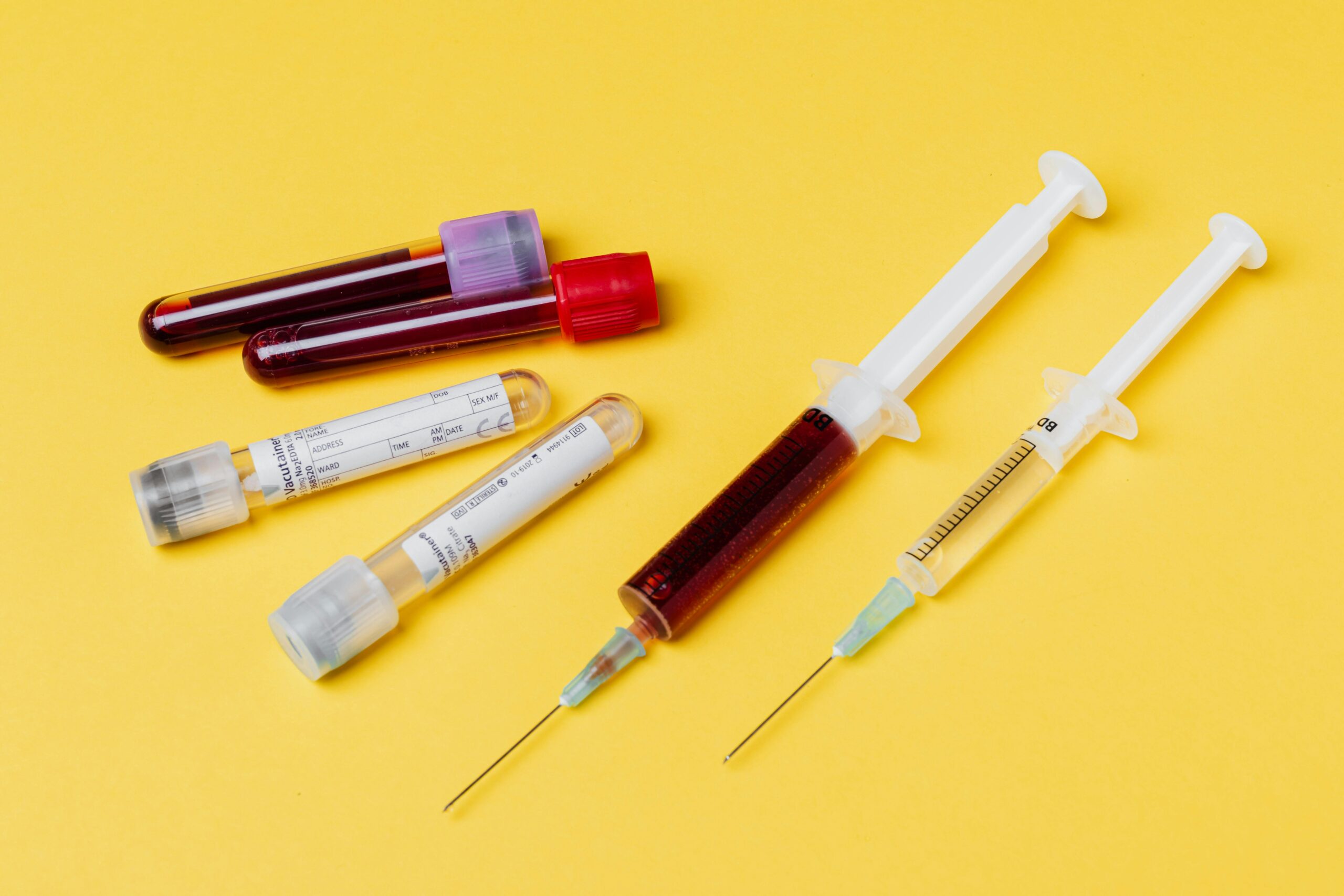 Syringes and test tubes with blood and plasma samples