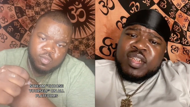 TikToker Shamelessly Admits He Faked Having Monkeypox To Promote His Music:  'I Have Unique And Unconventional Marketing Methods' - Blavity News