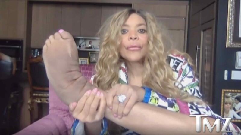Wendy Williams Says She Can Only Feel 5% Of Her Feet, Shows Her Lymphedema In Interview