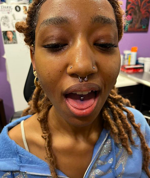 Orbital piercing of the tongue.