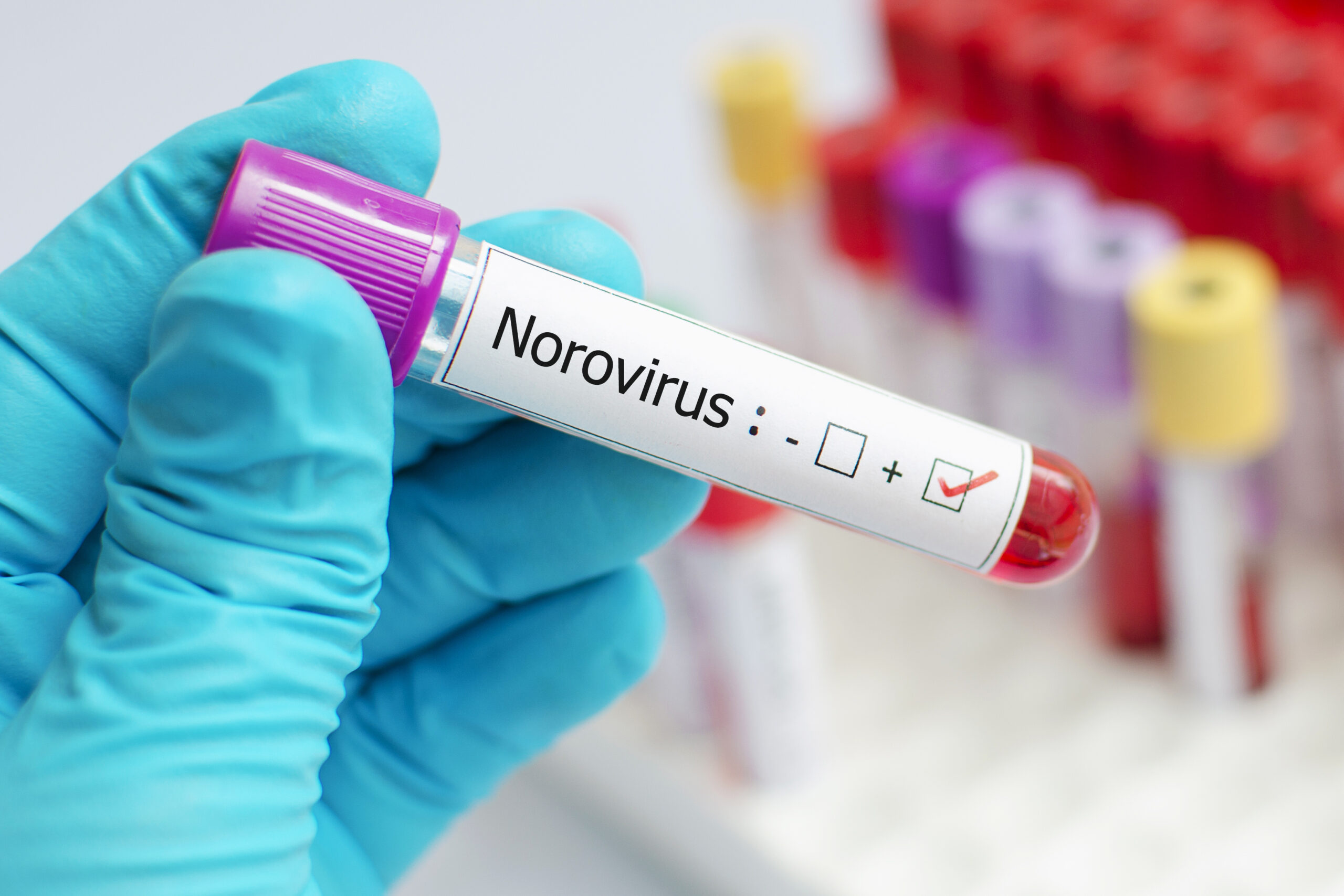 Norovirus Outbreak: U.S. Is Reporting The Highest Number Of Cases In A Decade — Here's What To Know