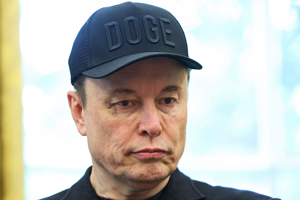 What Happened To Elon Musk’s Face? Here's Why He Has A Black Eye