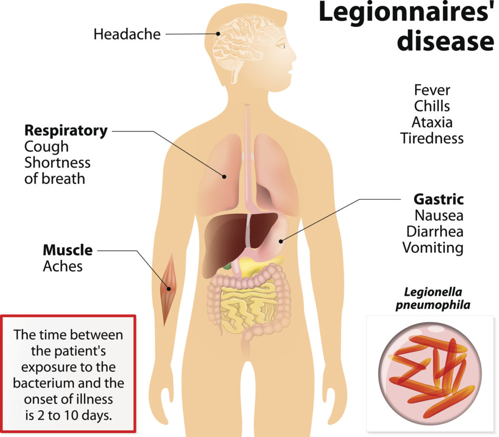 Legionnaires disease or legionellosis or Legion fever. Signs and symptoms  is a form of atypical pneumonia.  Human silhouette with highlighted internal organs